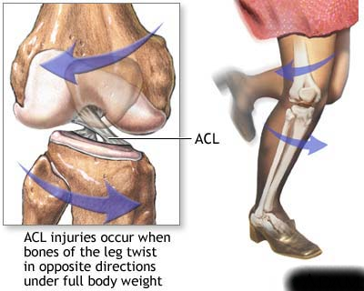 Image result for allografts acl